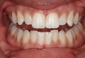 Family Dentist in Greensboro