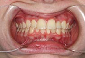 Emergency Dentist in Greensboro