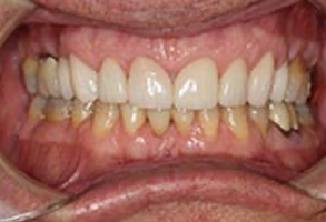 Dentist in Greensboro