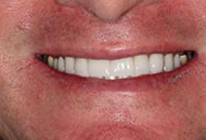 Greensboro Cosmetic Dentist