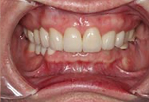 Emergency Dentist in Greensboro