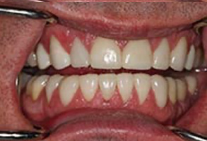 Pediatric Dentist Greensboro