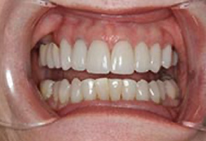 Emergency Dentist in Greensboro