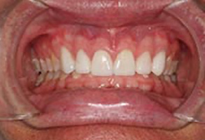 Family Dentist in Greensboro