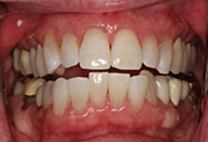 Dentist in Greensboro