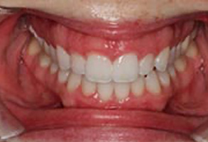 Greensboro Cosmetic Dentist