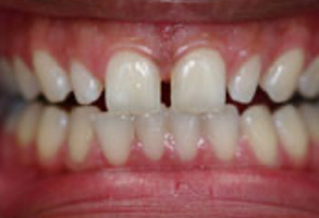 Greensboro Cosmetic Dentist