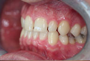 Emergency Dentist in Greensboro