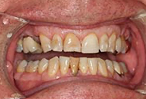 Family Dentist in Greensboro