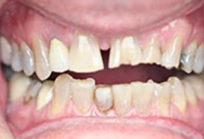 Greensboro Cosmetic Dentist