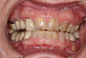 Greensboro Cosmetic Dentist