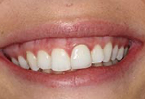 Pediatric Dentist Greensboro