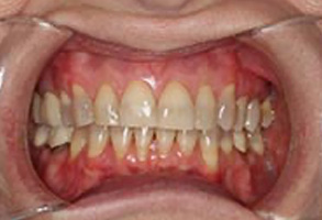 Dentist in Greensboro