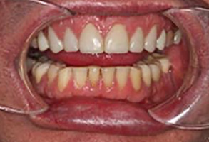 Dentist in Greensboro