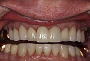 Greensboro Cosmetic Dentist