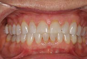 Emergency Dentist in Greensboro