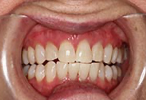 Dentist in Greensboro