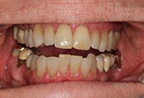 Dentist in Greensboro